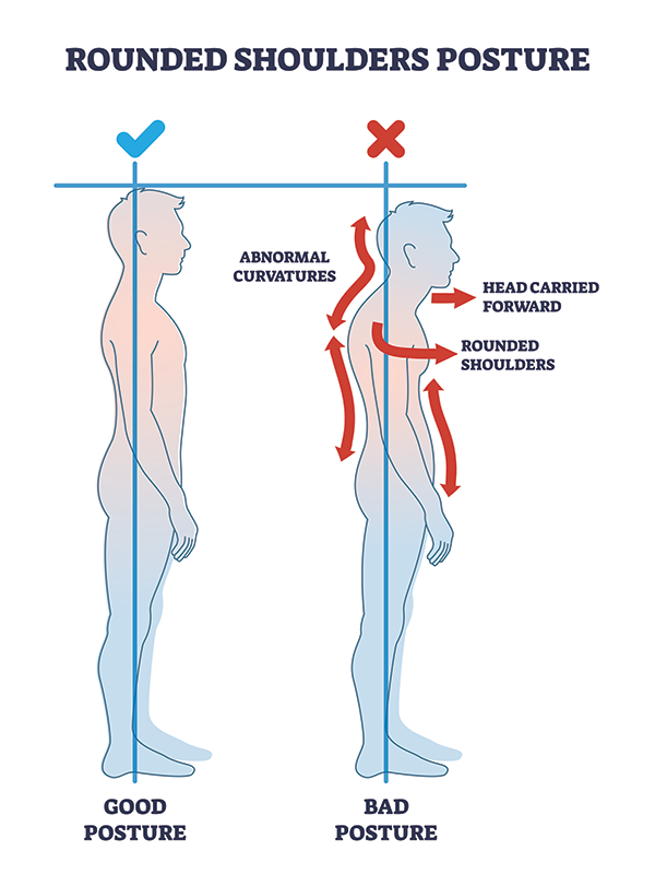 Educational illustration of rounded shoulders posture body alignment vs proper posture body alignment.